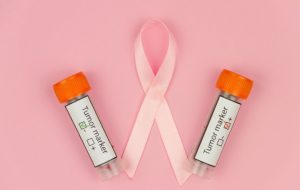 پیشبینی سرطان سینه با آزمایش خون جدید: سه سال زودتر از تشخیص تصویری پیشبینی سرطان سینه با آزمایش خون جدید: سه سال زودتر از تشخیص تصویری