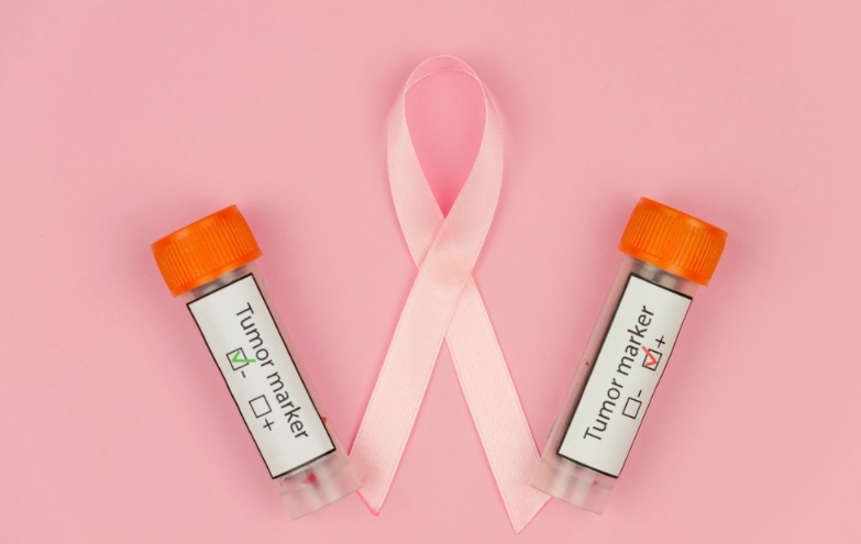 پیشبینی سرطان سینه با آزمایش خون جدید: سه سال زودتر از تشخیص تصویری پیشبینی سرطان سینه با آزمایش خون جدید: سه سال زودتر از تشخیص تصویری