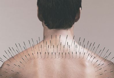 دکتر بدیعی: طب مکمل چینی به بهبود بیماران در کنار طب رایج کمک می‌کند